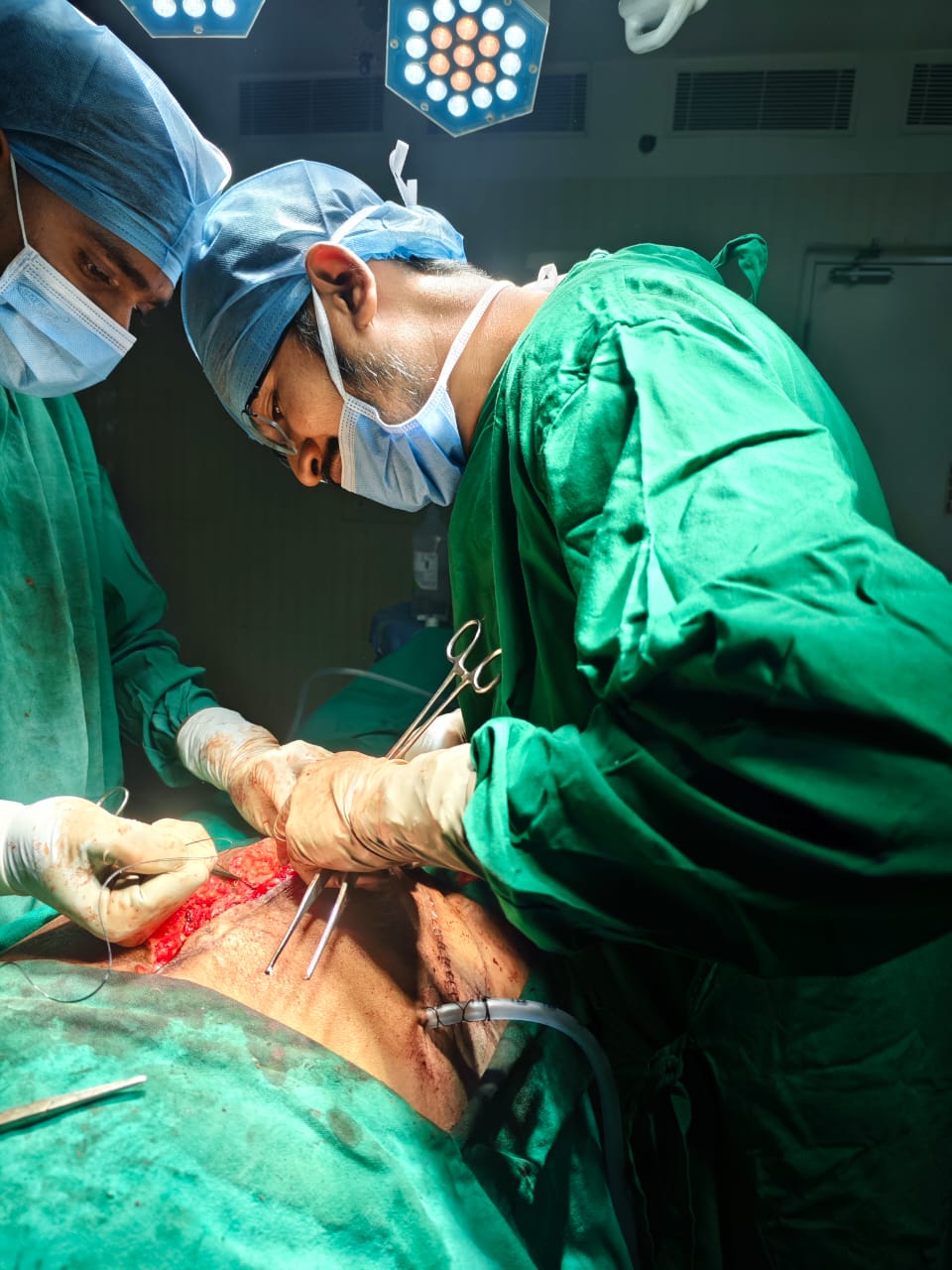  general surgery department at tulasi multispeciality hospital guntur 